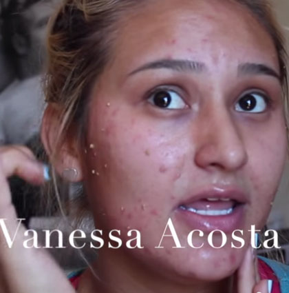 Vanessa Acosta LOVES OROGOLD 24K Deep Peeling Masks